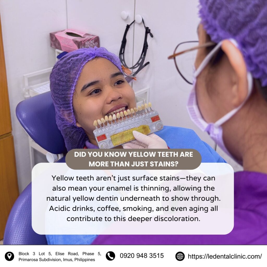 Teeth Whitening 1 teeth whitening 2